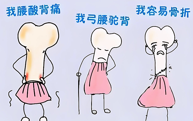 哪些人需要做骨密度检测.jpg